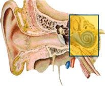Bio Image of Sensorineural Hearing Loss